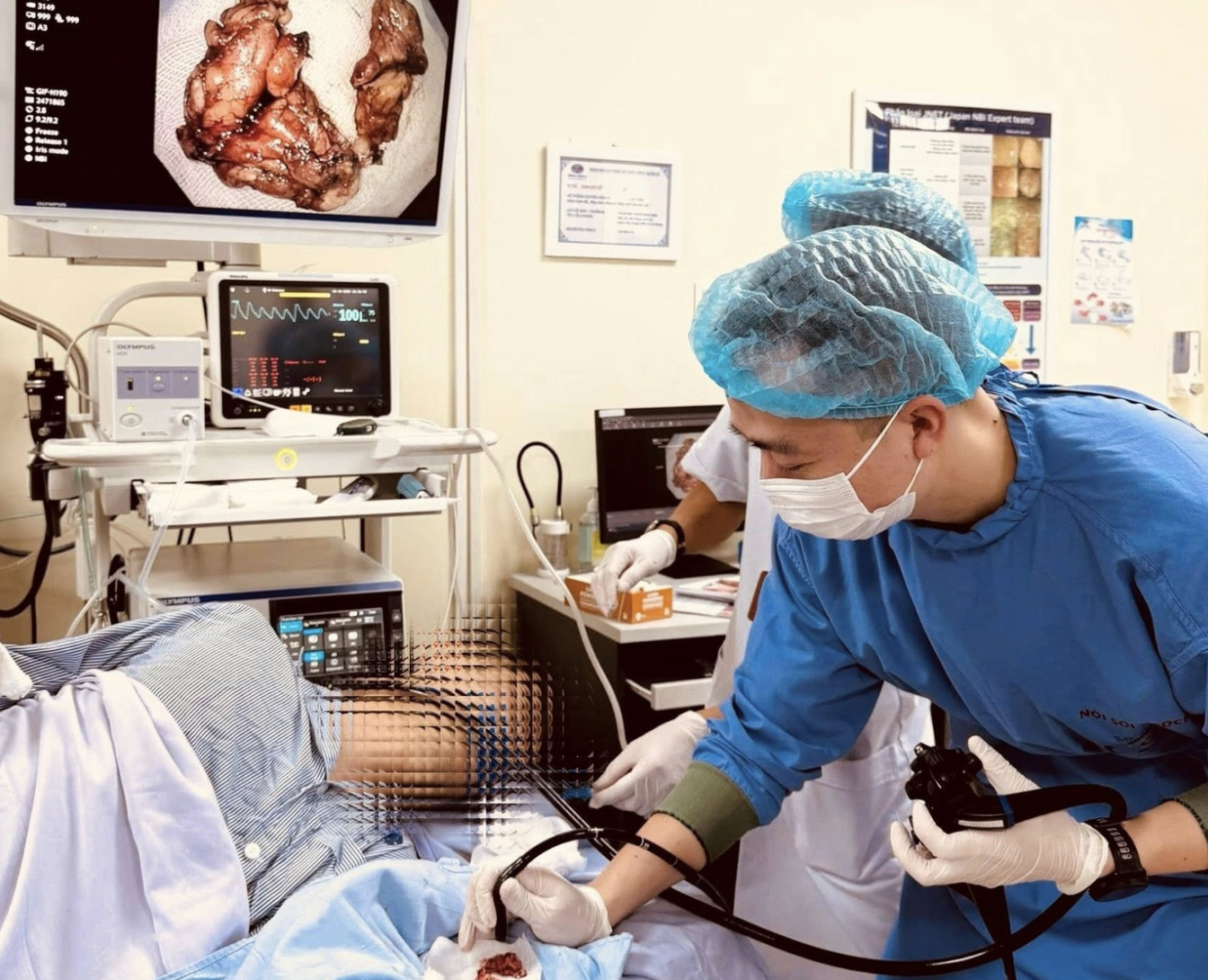 Kỹ thuật nội soi hiện đại giúp loại bỏ triệt để khối u thực quản lớn